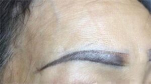 Xăm lông mày bị hỏng: Nguyên nhân và cách khắc phục