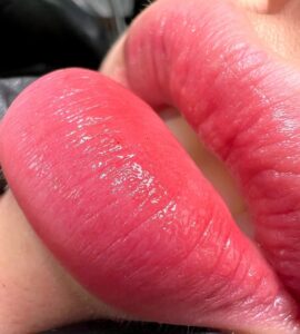 phun môi nano tai thẩm mỹ bảo anh