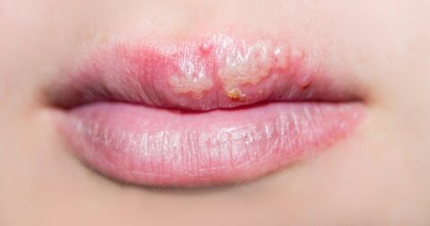 79d287a99f86d8e9609767c988c88041