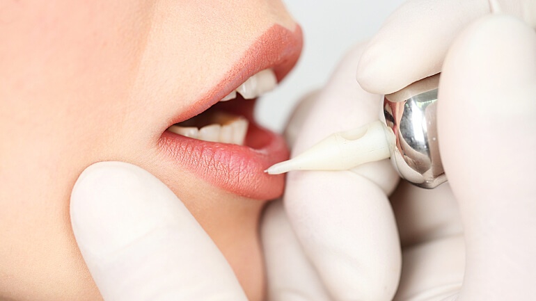 Phun môi mà không khử – khi nào nên, khi nào không?