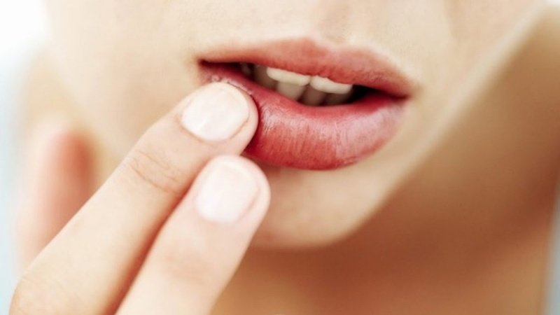 cach_boi_acyclovir_sau_phun_moi_3_4f366aa334 Bôi thuốc đều để đạt được hiệu quả như mong muốn