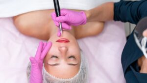 Chăm Sóc Môi Sau Phun