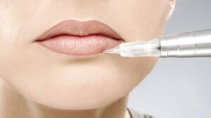 dau hieu phun moi bi hong la gi va cach xu ly q a oh b 1669820580 086f01b877