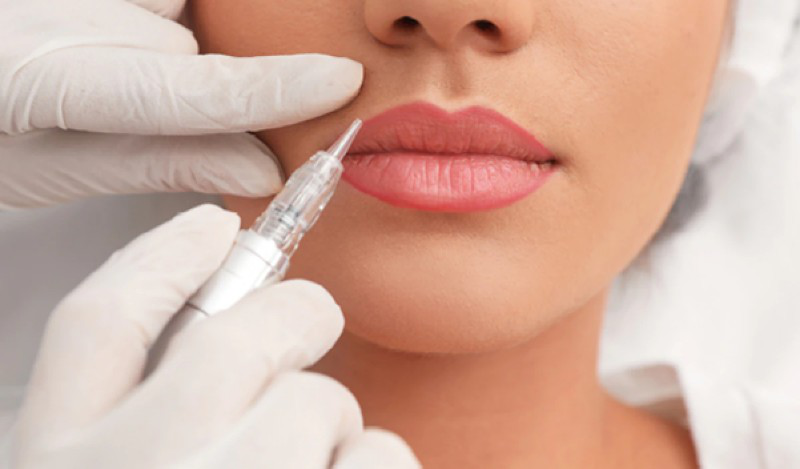goc_giai_dap_phun_moi_nano_kieng_gi_2_69f5aac55d Góc giải đáp: Phun môi nano kiêng gì? 2