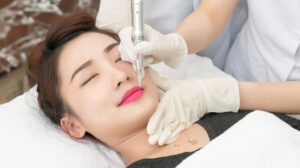 goc giai dap phun xam moi bao lau thi dam lai duoc po rms 1669807167 a8fce43251 1