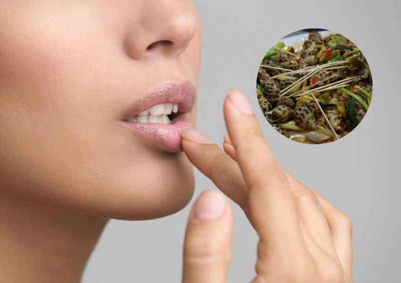 Góc giải đáp xăm môi ăn ốc được không? Lỡ ăn ốc phải làm sao? 1
