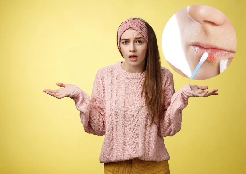 Góc giải đáp xăm môi bị chảy nước vàng có sao không và cách xử trí đúng3