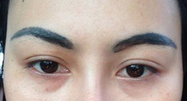 long may bi tro xanh e1764138353992