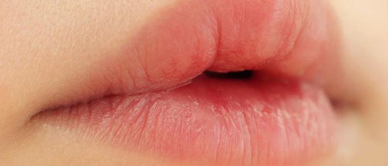 nguyen_nhan_khien_ban_tu_nhien_bi_sung_moi_1_ba1b067f39 Lỡ ăn hải sản sau khi xăm môi có sao không? 2
