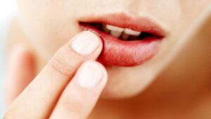 nguyen nhan va cach xu ly khi di xam moi ve bi sung od xn w 1671797049 be8d5e3a7d