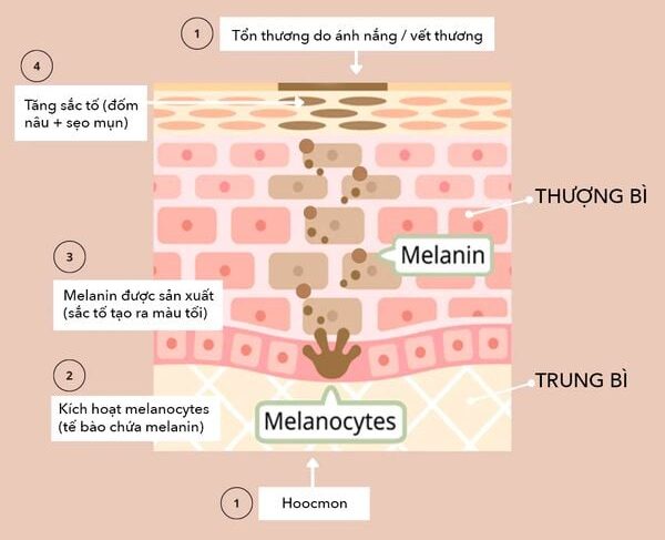 Giải pháp xóa quầng thâm mắt triệt để, trả lại đôi mắt tươi trẻ 3 Để xóa quầng thâm mắt triệt để, cần áp dụng các công nghệ cao nhằm can thiệp tận gốc vào hắc sắc tố melanin dưới da.