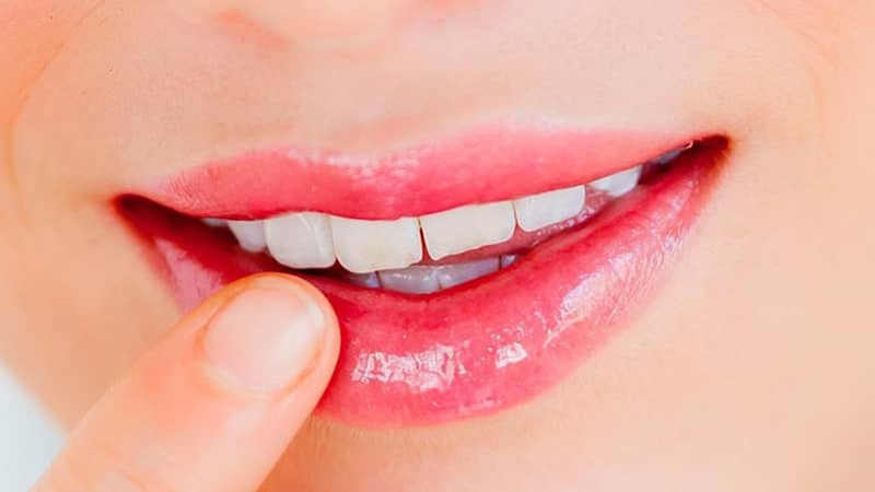 Phun môi collagen bao lâu thì bong?