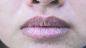 Phun môi không lên màu phải làm sao?