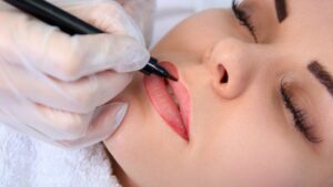 Phun môi tế bào gốc