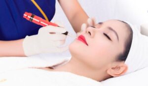 So sánh phun môi pha lê và phun môi collagen. Nên chọn kỹ thuật nào?