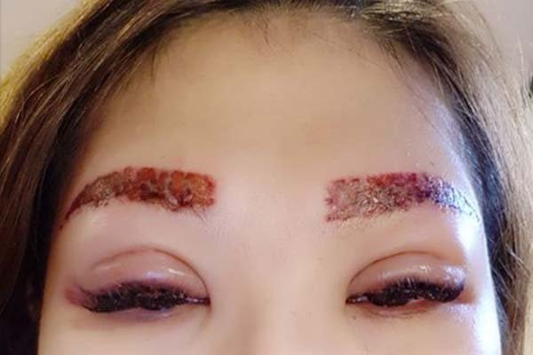 Thời gian sửa lại chân mày bị hỏng do phun tùy thuộc vào tình trạng lỗi.