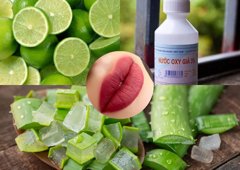 Sử dụng nha đam, chanh tươi hoăc oxy già giúp giảm bớt tình trạng viền môi đậm Sử dụng nha đam, chanh tươi hoăc oxy già giúp giảm bớt tình trạng viền môi đậm