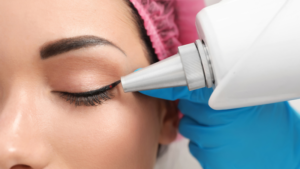 Xóa xăm mí mắt có đem lại rủi ro gì hay không?