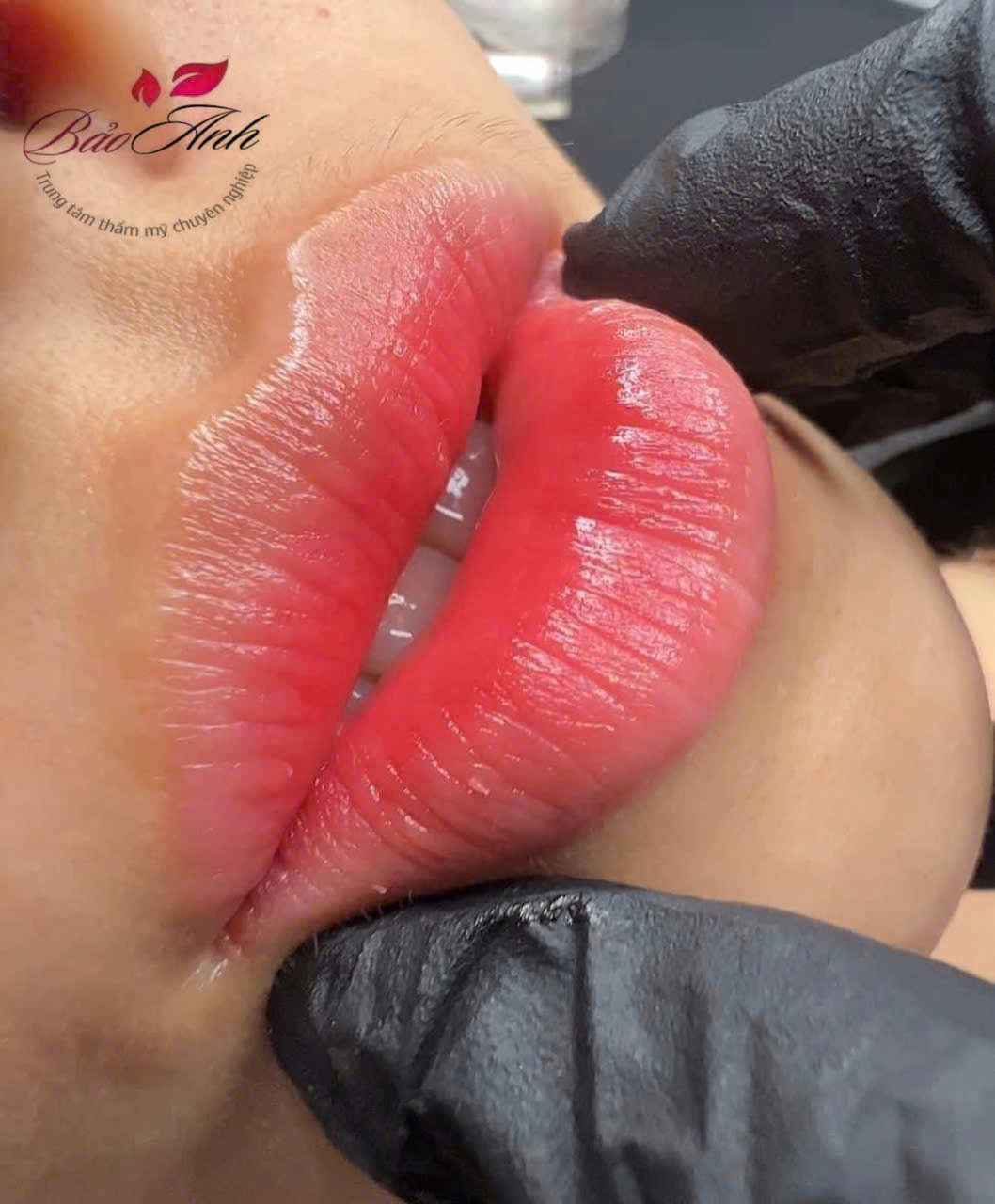 Sau khi xăm môi ăn mực được không? 1 Sau khi xăm môi ăn mực được không?