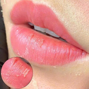 Từ phun môi bị phai màu xấu đến màu đẹp: Case trước/after thật