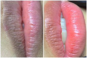 Phun môi xong bị loang màu: Dấu hiệu bình thường hay lỗi kỹ thuật?