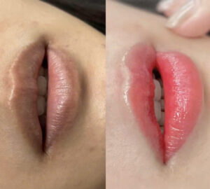 Phun môi nhẹ màu – Vì sao vẫn căng bóng?