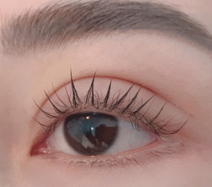 Bao nhiêu tuổi thì cắt mí được