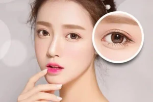 133 cat mi tai Thanh Hoa 2.jpg