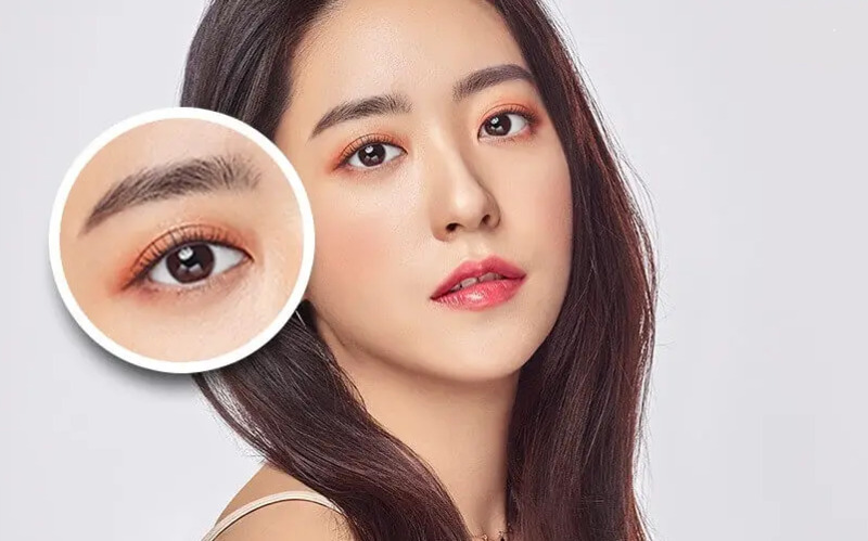 Mở rộng góc mắt trong 5 Cắt mí bao lâu thì đẹp tự nhiên