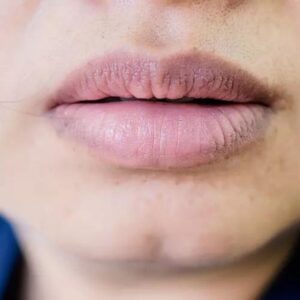 Môi thâm dùng son màu