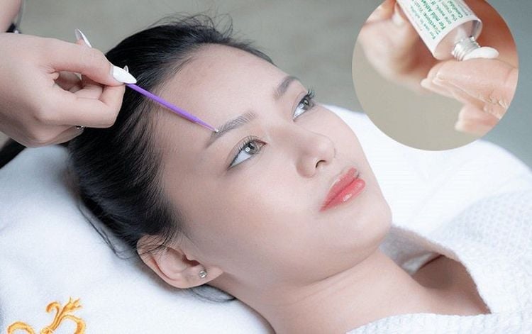 Có nên làm chân mày không? Những rủi ro & lời khuyên từ chuyên gia 3 3 92cd992e9404445d875f7ce2a93f6cf9