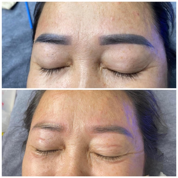 5 Lưu Ý Khi Xóa Xăm Chân Mày Bằng Laser 1 400233489 1058166852031499 5923488797431286231 n