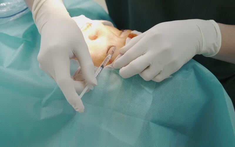 Bấm mí mắt 9 7mEyUkC7 bam mi mat 15 e1758726557903