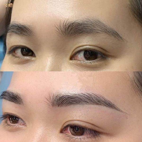 Khắc phục phun mày không lên màu: Nguyên nhân và giải pháp hiệu quả nhất 2 987398bc7b12248edf98bfcda674a686