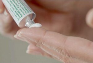 Mí bị căng hoặc khô sau phun – có nên bôi kem dưỡng?