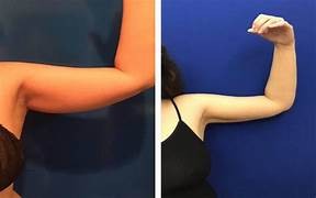 thon gọn bắp tay