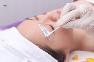 Quy trinh xoa long may theu bang laser