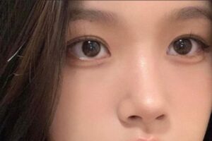 Phun mí mở tròng là gì?