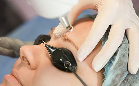 Xóa xăm chân mày bằng laser mấy lần thì hết sạch Xóa xăm chân mày bằng laser mấy lần thì hết sạch