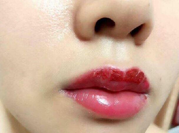 Phun môi màu đỏ cam đào phù hợp với ai? 5 Phun môi 2 ngày đã bong có hỏng