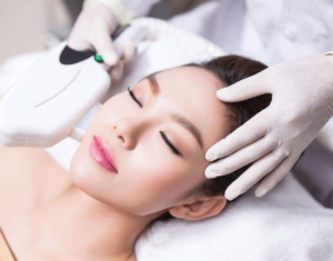 nâng cơ xóa nọng cằm