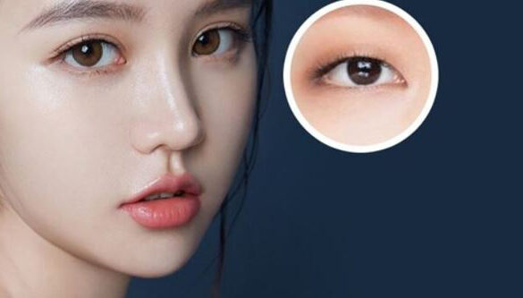 Bấm mí mắt 1 bam mi mat 1 e1758726222688