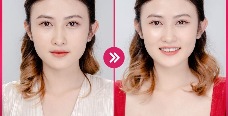 Bấm mí mắt 8 bam mi mat 10 e1758726672384