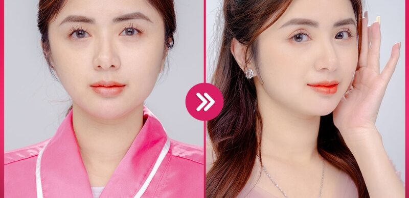 Bấm mí mắt 7 bam mi mat 9 e1758726645731