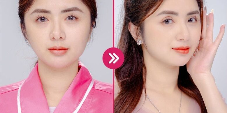 Nhấn mí kiêng ăn gì? Kiêng trong bao lâu? 16 bam mi mat 9 e1758773817681