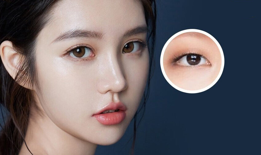 Nhấn mí Hàn Quốc là gì? Nhấn mí Hàn Quốc là gì?