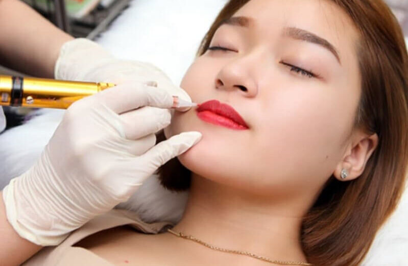 Bị tiểu đường xăm môi có được không? Cần phải lưu ý điều gì? 3 bi tieu duong co xam moi duoc khong 03 662f19108248d e1757731754454