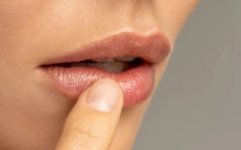 Bị tiểu đường xăm môi có được không? Cần phải lưu ý điều gì? 5 bi tieu duong co xam moi duoc khong 05 662f191268d0f e1757731739902