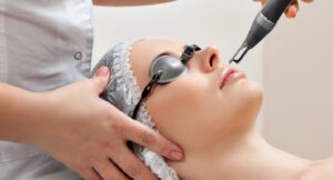 Xoá xăm lông mày bằng laser có để lại sẹo không