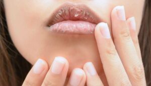 Môi khô bẩm sinh vẫn lên màu đẹp nếu làm đúng kỹ thuật